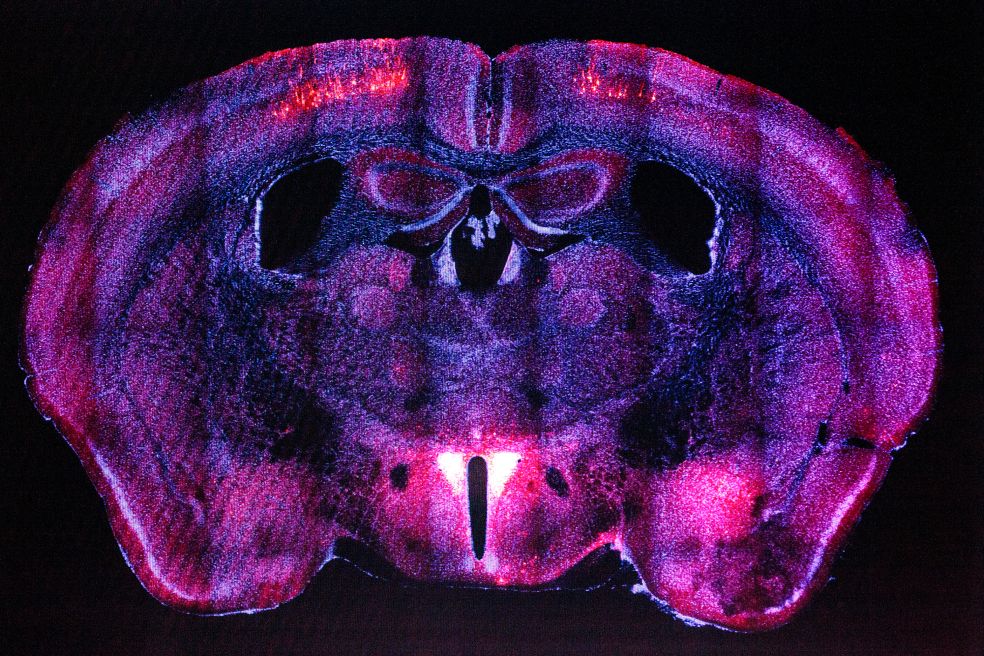 Korssnitt av en anatomisk struktur med färgglada detaljer i lila och rosa.