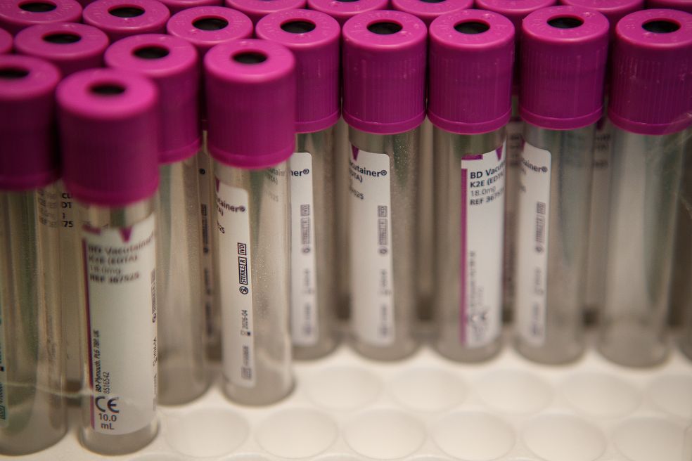 Rör med lila korkar staplade i en labbmiljö.