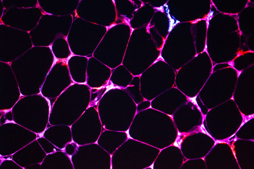 Färgglada cellstrukturer på mörk bakgrund, med ljusa linjer mellan cellerna.