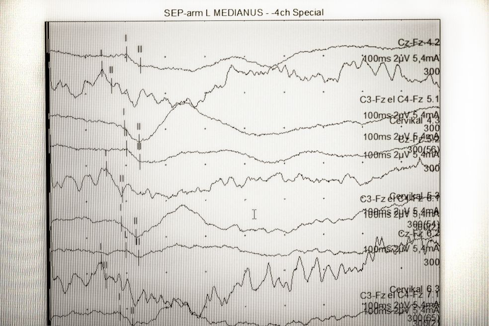 Grafik med flera vågformer som visar data över tid och olika mätningar.