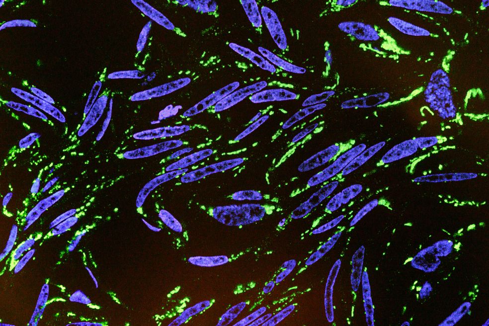 Fluorescerande celler med blå och grön färg på mörk bakgrund.