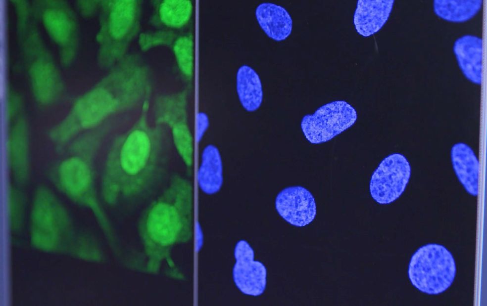 The Human Protein Atlas Project Knut and Alice Wallenberg Foundation