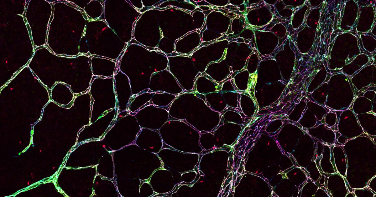 An atlas of the body's blood vessels | Knut and Alice Wallenberg