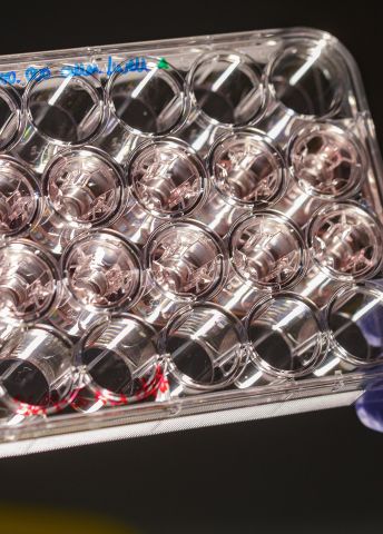 En laboratorieplatta med cellkulturer i händerna på en person med handskar.