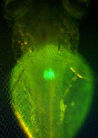 mikroskopbild-gron-tryggvason-m.jpg