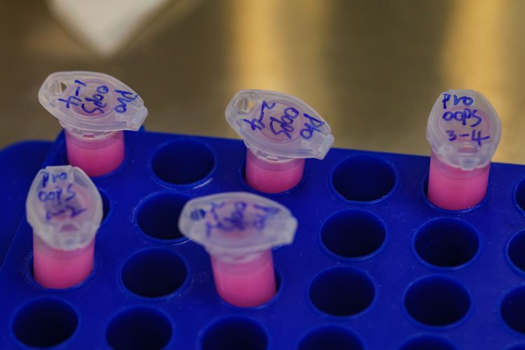 Fem provrör med rosa vätska i en blå rack.