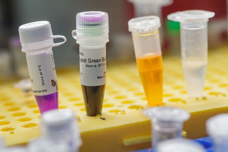 Flera provrör med olika färgade vätskor på en rack.